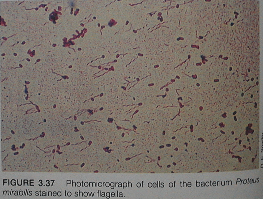 细菌的鞭毛染色
